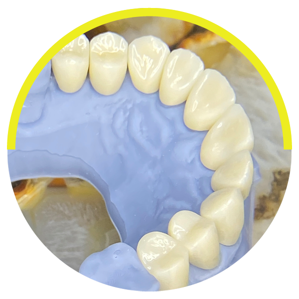 https://dentalartstudio.ca/wp-content/uploads/2023/07/Zirconium-Crowns.png