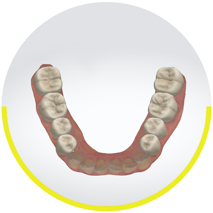 https://dentalartstudio.ca/wp-content/uploads/2023/07/banner-Diagnostic-Wax-Up-DAS.png