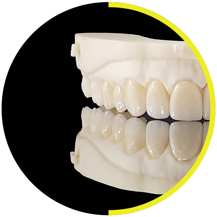 https://dentalartstudio.ca/wp-content/uploads/2023/07/banner-Veneers-DAS.png