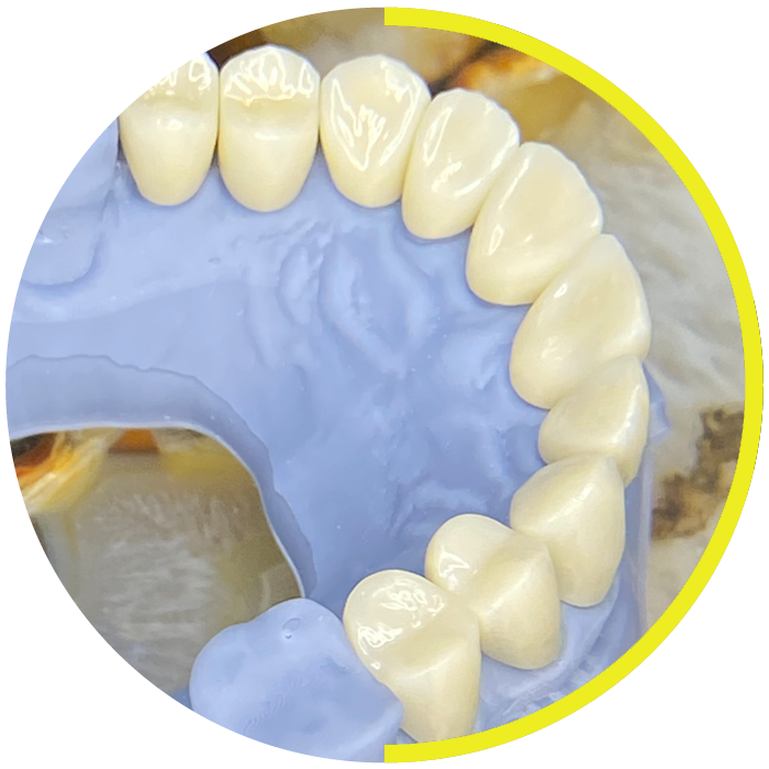 https://dentalartstudio.ca/wp-content/uploads/2023/07/banner-Zirconium-Crowns.png
