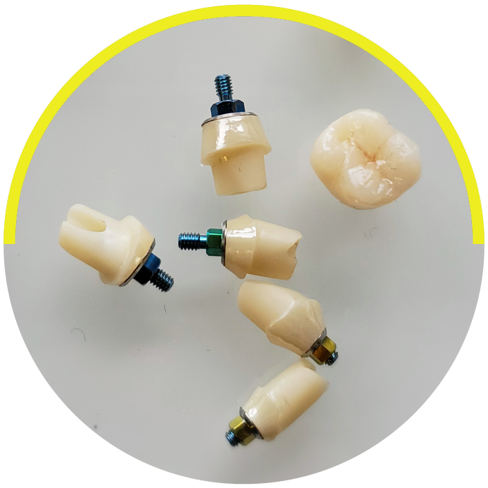 https://dentalartstudio.ca/wp-content/uploads/2023/07/banner-Zirconium-Custom-Abutment.png