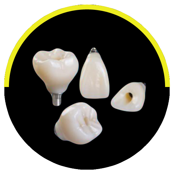 https://dentalartstudio.ca/wp-content/uploads/2023/08/Screw-Retained.png