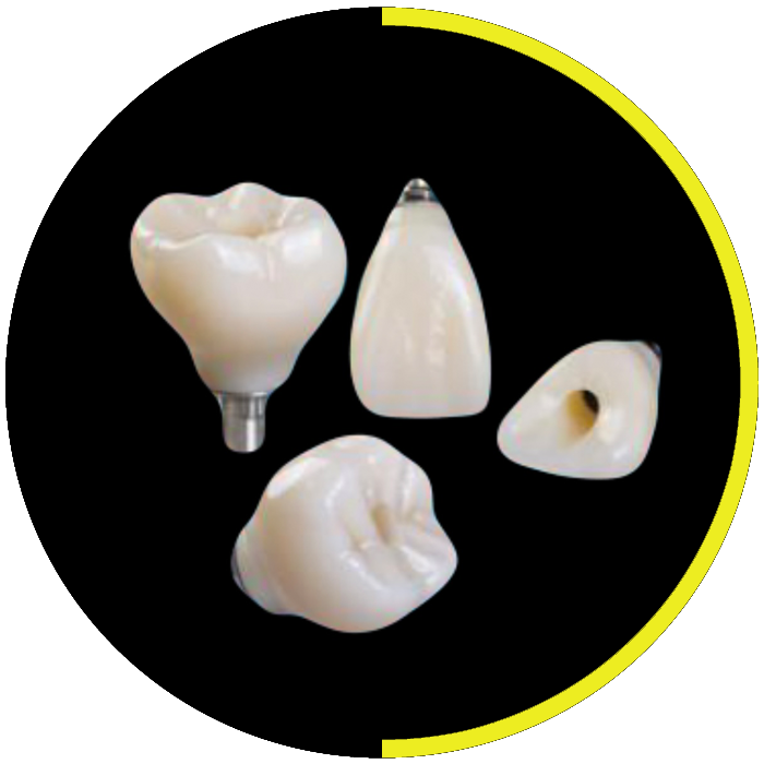 https://dentalartstudio.ca/wp-content/uploads/2023/08/banner-Screw-Retained-DAS.png