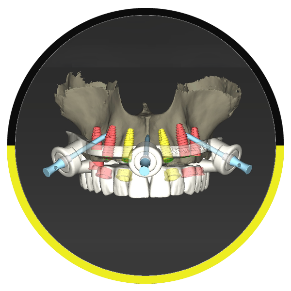 https://dentalartstudio.ca/wp-content/uploads/2026/10/Digital-Surgical-Guide.png