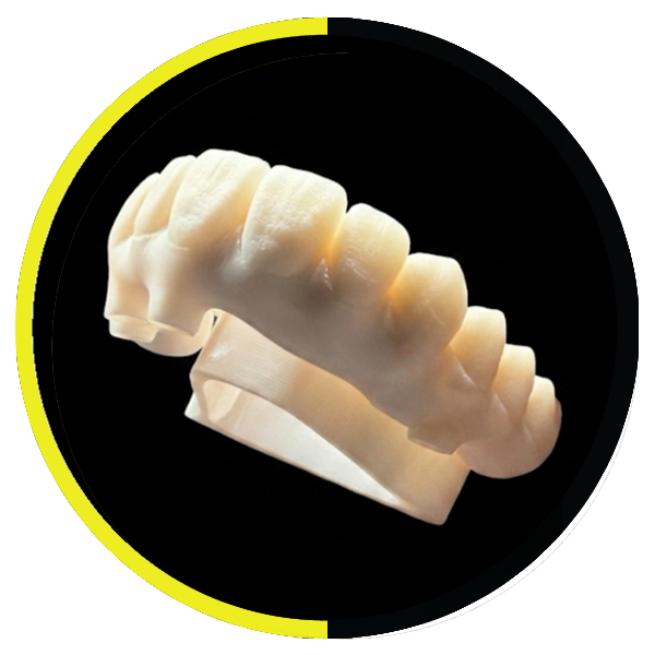 https://dentalartstudio.ca/wp-content/uploads/2026/10/Prettau-Zirconia-Bridges-DAS.png