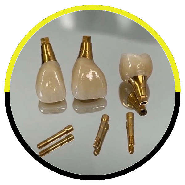 https://dentalartstudio.ca/wp-content/uploads/2026/10/ScrewRetained.png